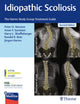 Book cover of: Idiopathic Scoliosis. By: Peter Newton