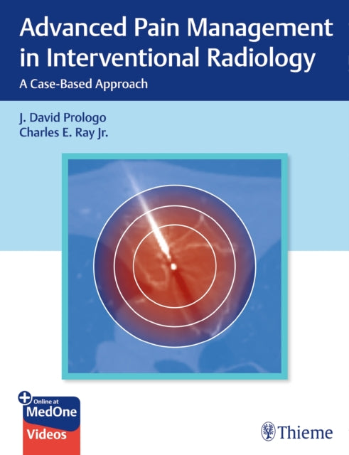 Book cover of: Advanced Pain Management in Interventional Radiology. By: Charles Ray