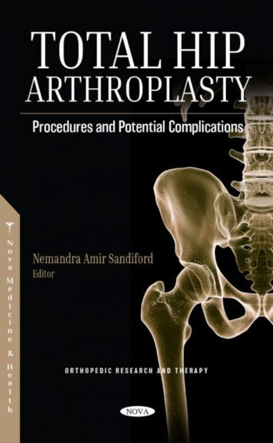Book cover of: Total Hip Arthroplasty. By: Nemandra Amir Sandiford