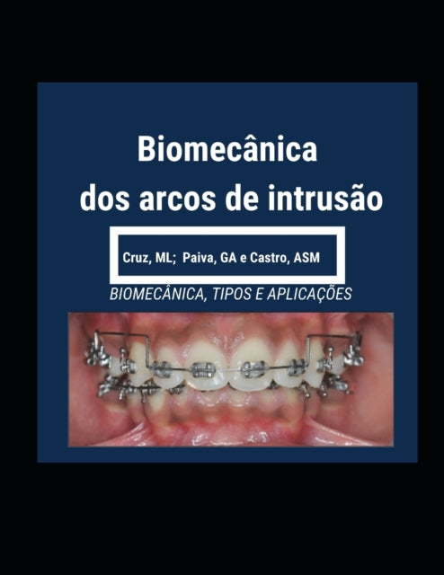 Book cover of: Biomecanica dos Arcos de Intrusao. By: Glauci Paiva