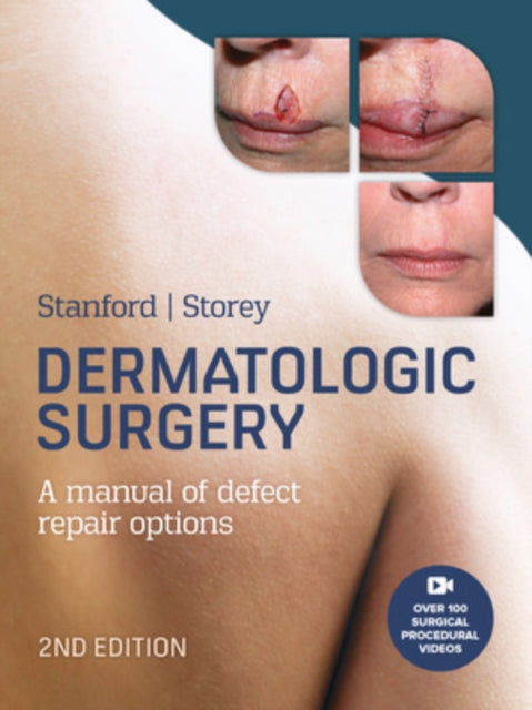Book cover of: Dermatologic Surgery. By: Duncan Stanford