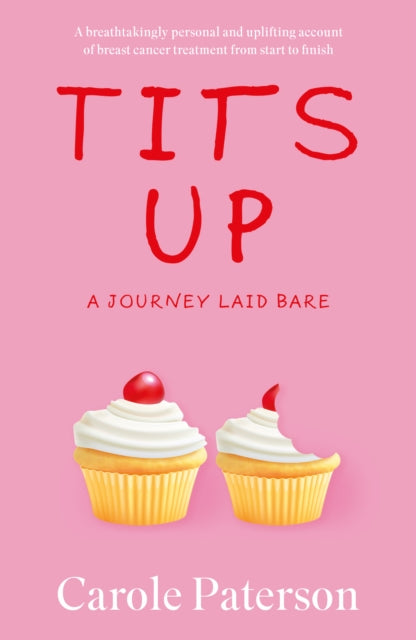 Book cover of: Tits Up. By: Carole Paterson
