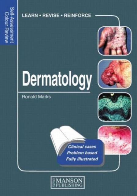Book cover of: Dermatology. By: Ronald Marks