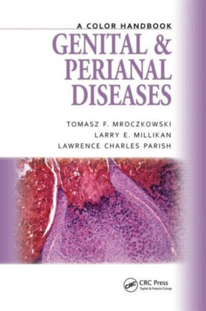 Book cover of: Genital and Perianal Diseases