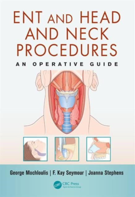 Book cover of: ENT and Head and Neck Procedures