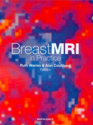 Breast MRI in Practice