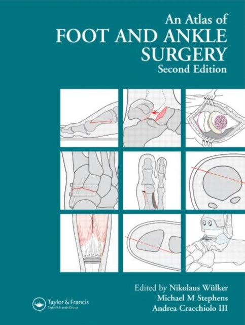 Book cover of: Atlas Foot and Ankle Surgery