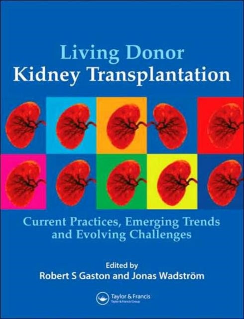 Book cover of: Living Donor Kidney Transplantation