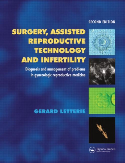 Book cover of: Surgery, Assisted Reproductive Technology and Infertility. By: Gerard S. Letterie