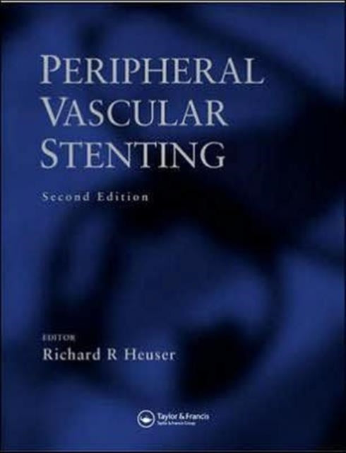 Book cover of: Peripheral Vascular Stenting, Second Edition