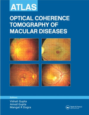 Atlas of Optical Coherence Tomography of Macular Diseases