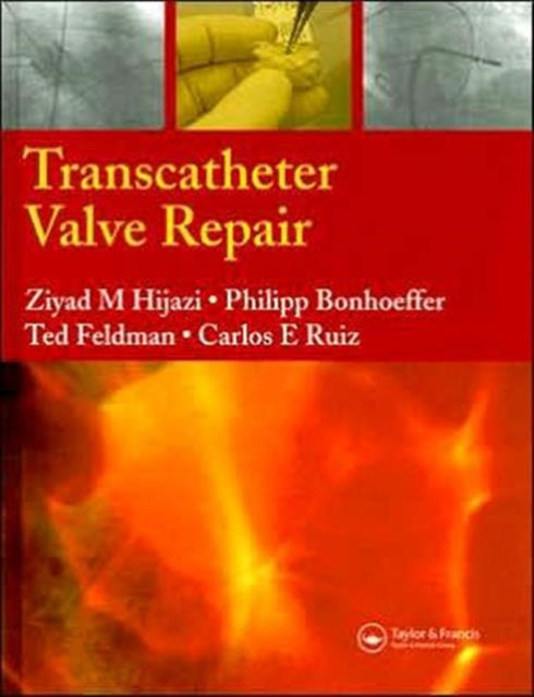 Book cover of: Transcatheter Valve Repair