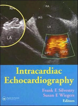 Intracardiac Echocardiography