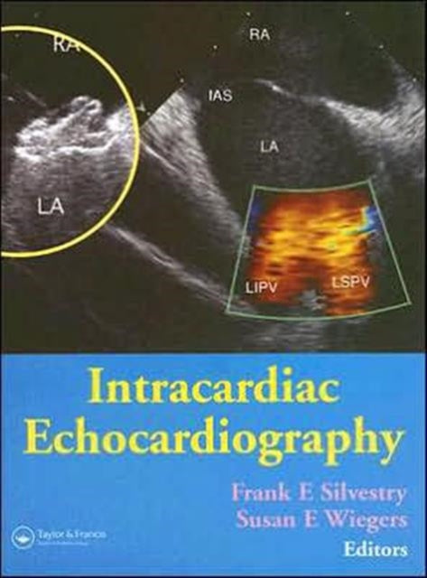 Book cover of: Intracardiac Echocardiography