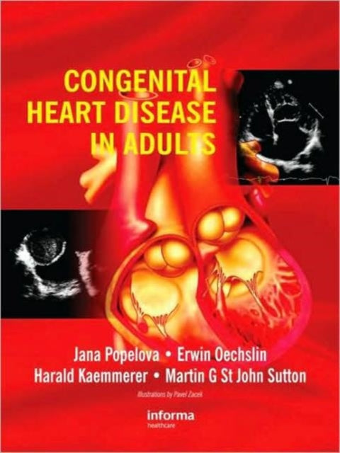 Book cover of: Congenital Heart Disease in Adults. By: Jana Popelova