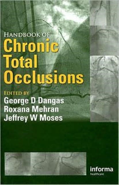 Book cover of: Handbook of Chronic Total Occlusions