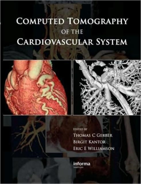Book cover of: Computed Tomography of the Cardiovascular System