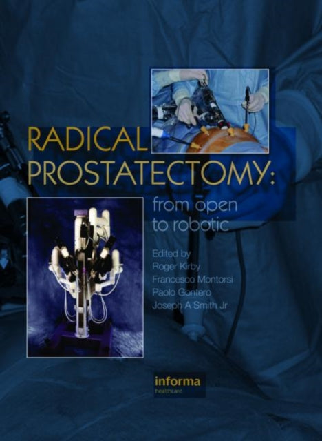 Book cover of: Radical Prostatectomy