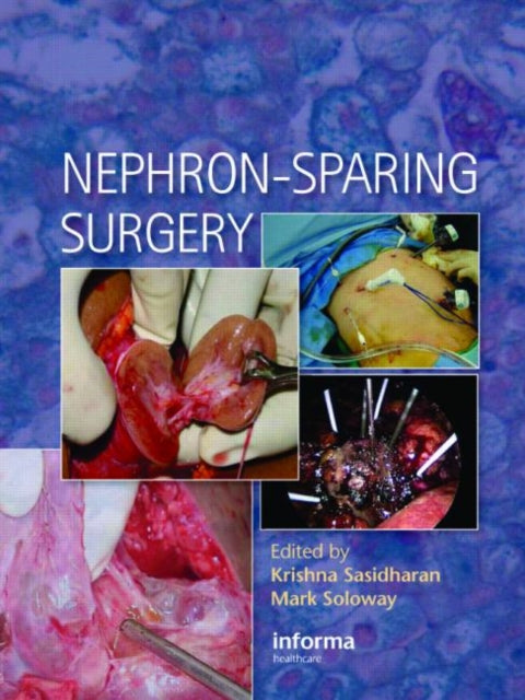 Book cover of: Nephron-Sparing Surgery