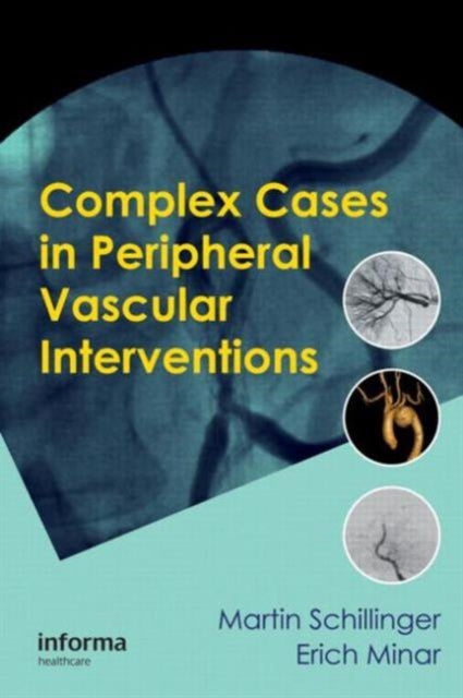 Book cover of: Complex Cases in Peripheral Vascular Interventions. By: Martin Schillinger
