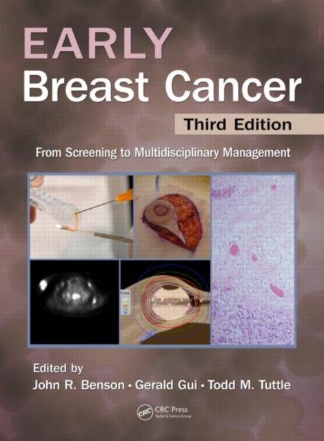 Book cover of: Early Breast Cancer. By: John R. Benson