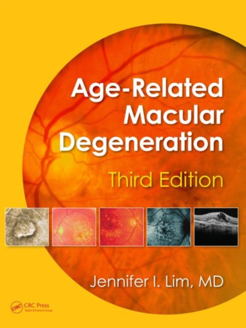 Book cover of: Age-Related Macular Degeneration, Third Edition. By: Jennifer I. Lim