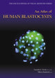 Book cover of: Atlas of Human Blastocysts. By: Lucinda L. Veeck