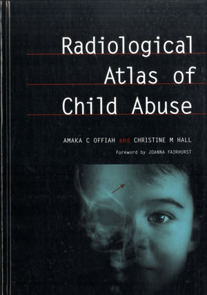 Radiological Atlas of Child Abuse