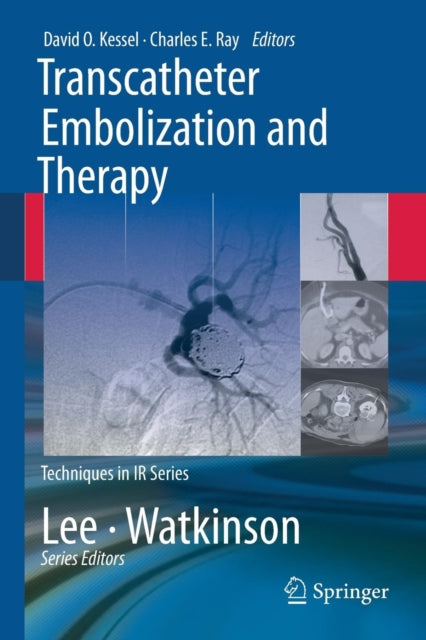 Book cover of: Transcatheter Embolization and Therapy. By: David O. Kessel