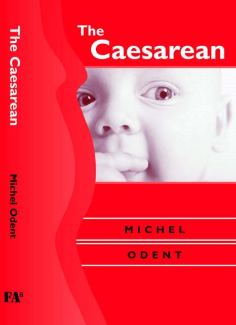 Book cover of: Caesarean