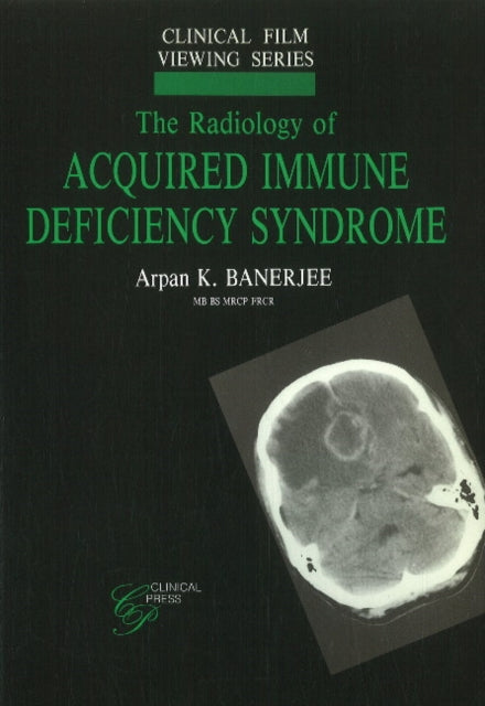 Book cover of: Radiology of Acquired Immune Deficiency Syndrome. By: A. Banerjee