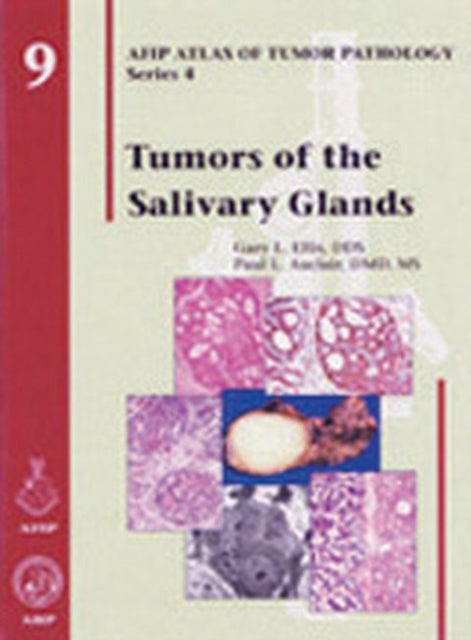 Book cover of: Tumors of the Salivary Glands. By: Robert J. Kruman