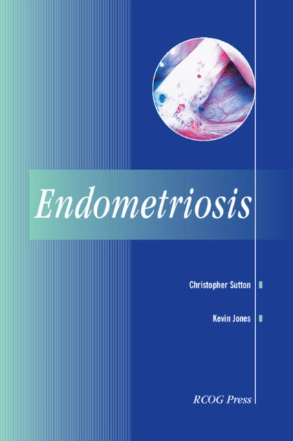 Book cover of: Endometriosis. By: David Lvesley