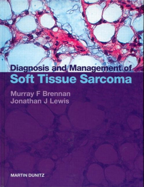 Book cover of: Diagnosis and Management of Soft Tissue Sarcoma. By: Murray Brennan