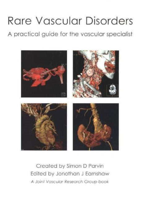 Book cover of: Rare Vascular Disorders