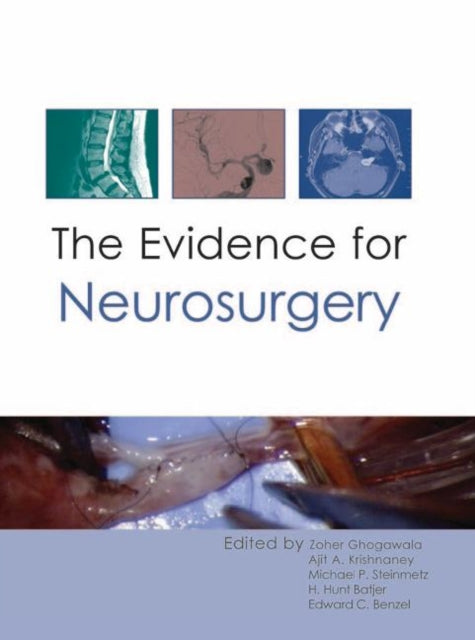 Book cover of: Evidence for Neurosurgery