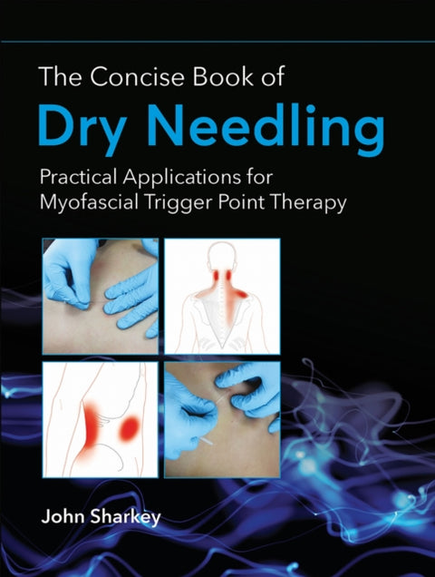 The Concise Book of Dry Needling