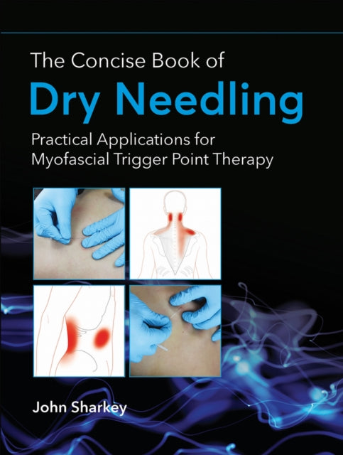 Book cover of: Concise Book of Dry Needling. By: John Sharkey