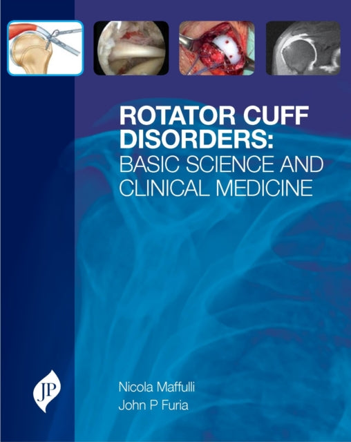 Book cover of: Rotator Cuff Disorders. By: Nicola Maffulli