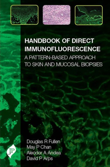 Book cover of: Handbook of Direct Immunofluorescence. By: Douglas Fullen