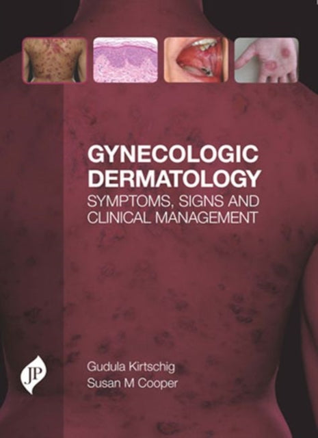 Book cover of: Gynecologic Dermatology. By: Gudula Kirtschig
