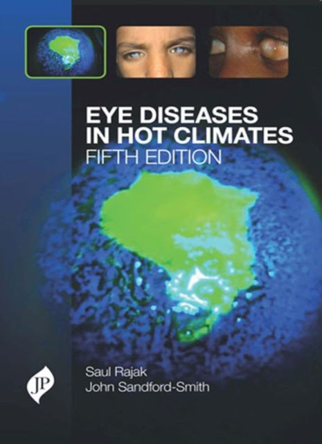 Book cover of: Eye Diseases in Hot Climates. By: Saul Rajak