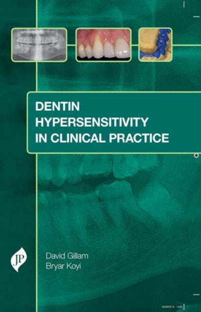 Book cover of: Dentin Hypersensitivity in Clinical Practice. By: David Gillam