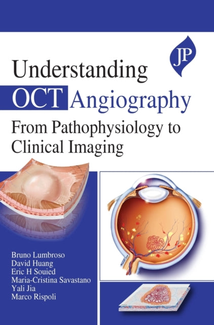 Book cover of: Understanding OCT Angiography. By: Bruno Lumbroso
