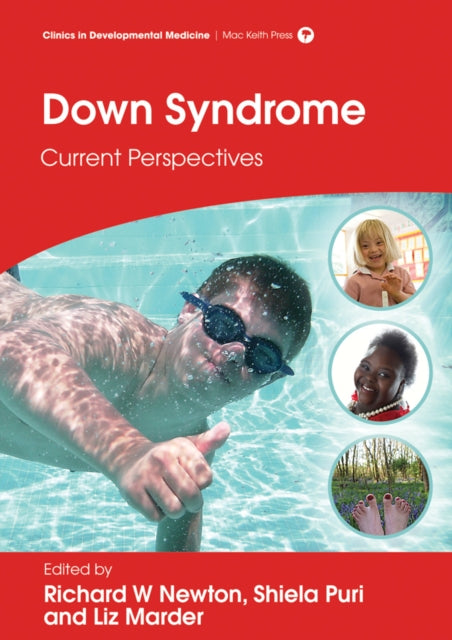 Book cover of: Down Syndrome. By: Richard W. Newton