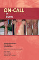 Book cover of: On-Call in Burns. By: Weale MANTELAKIS