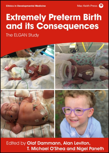 Book cover of: Extremely Preterm Birth and its Consequences. By: Olaf Dammann