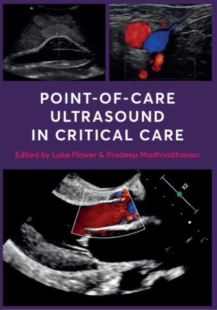 Book cover of: Point-of-Care Ultrasound in Critical Care. By: Luke Flower