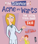 Book cover of: Science Of Acne & Warts. By: Alex Woolf