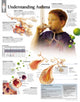 Book cover of: Understanding Asthma Laminated Poster. By: Scientific Publishing